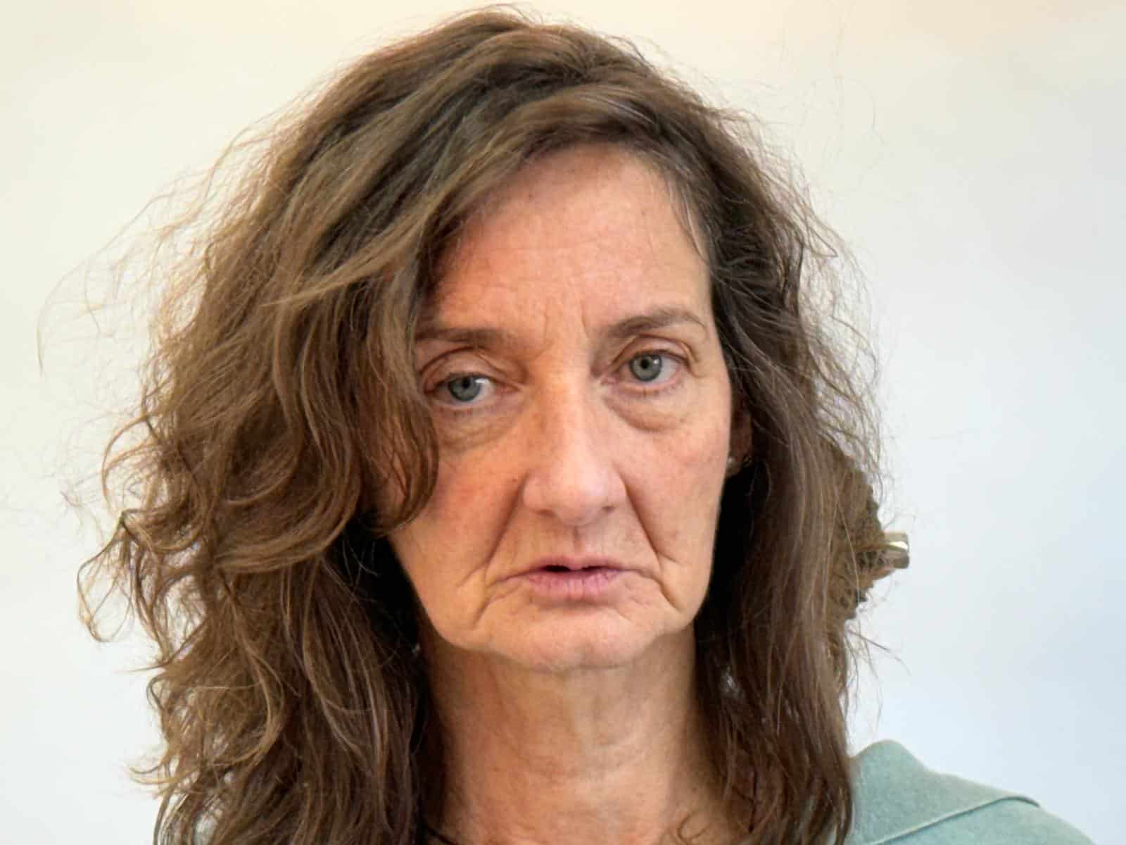 Zahnprothesen bei komplettem Zahnverlust